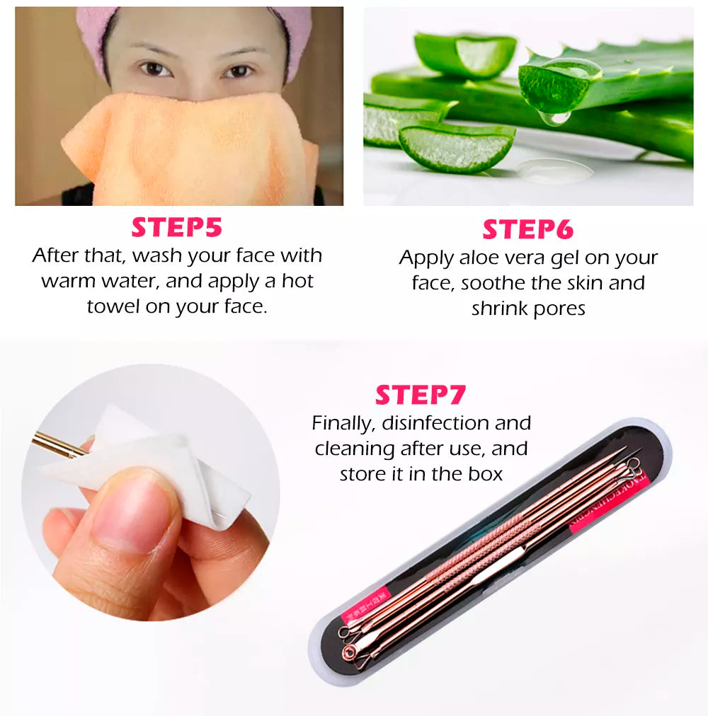 Kit Removedor de Acné / Espinillas / Puntos Negros | 4 Piezas de Doble Cabeza + Estuche | Acero Inoxidable | CHO-CPE-03